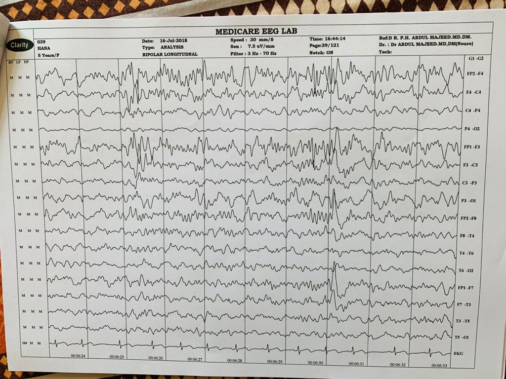 Patient Story